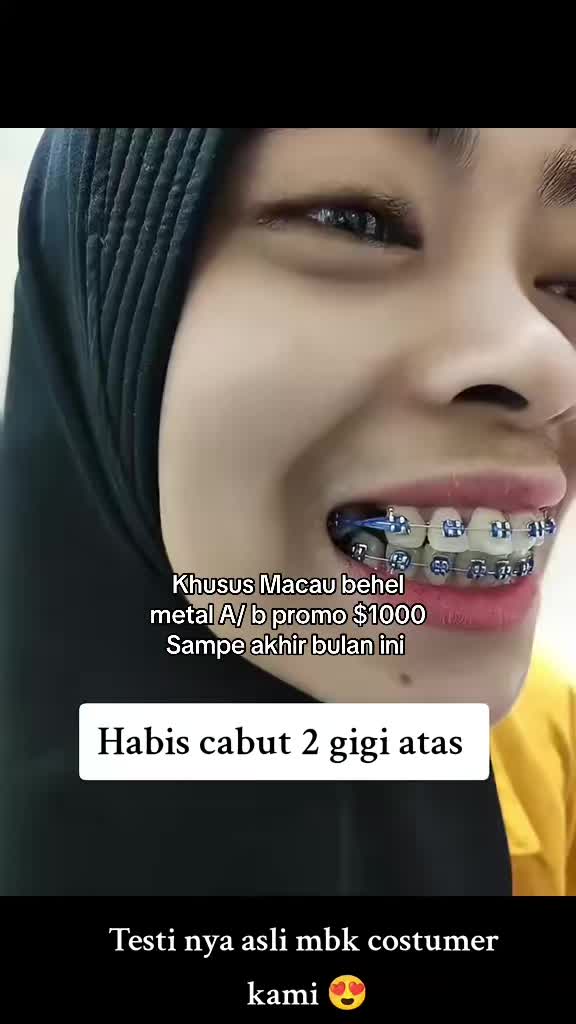 @mbak-Paijem