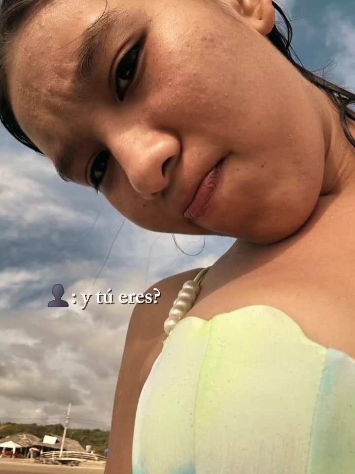 @****