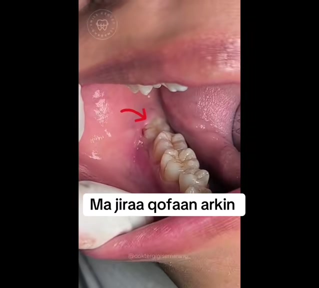 @Dr Abdirahman hassan laari