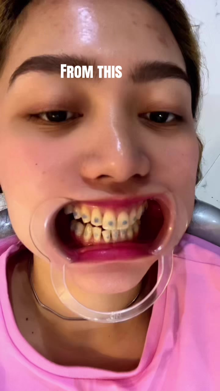 @Nurse Jing ๐ต๐ญ๐ธ๐ฆ