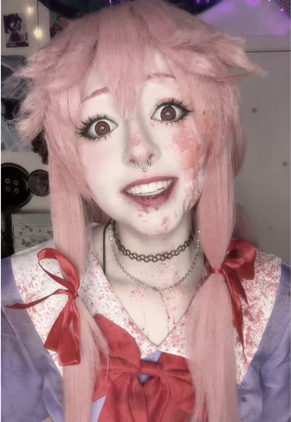 @Xoe
