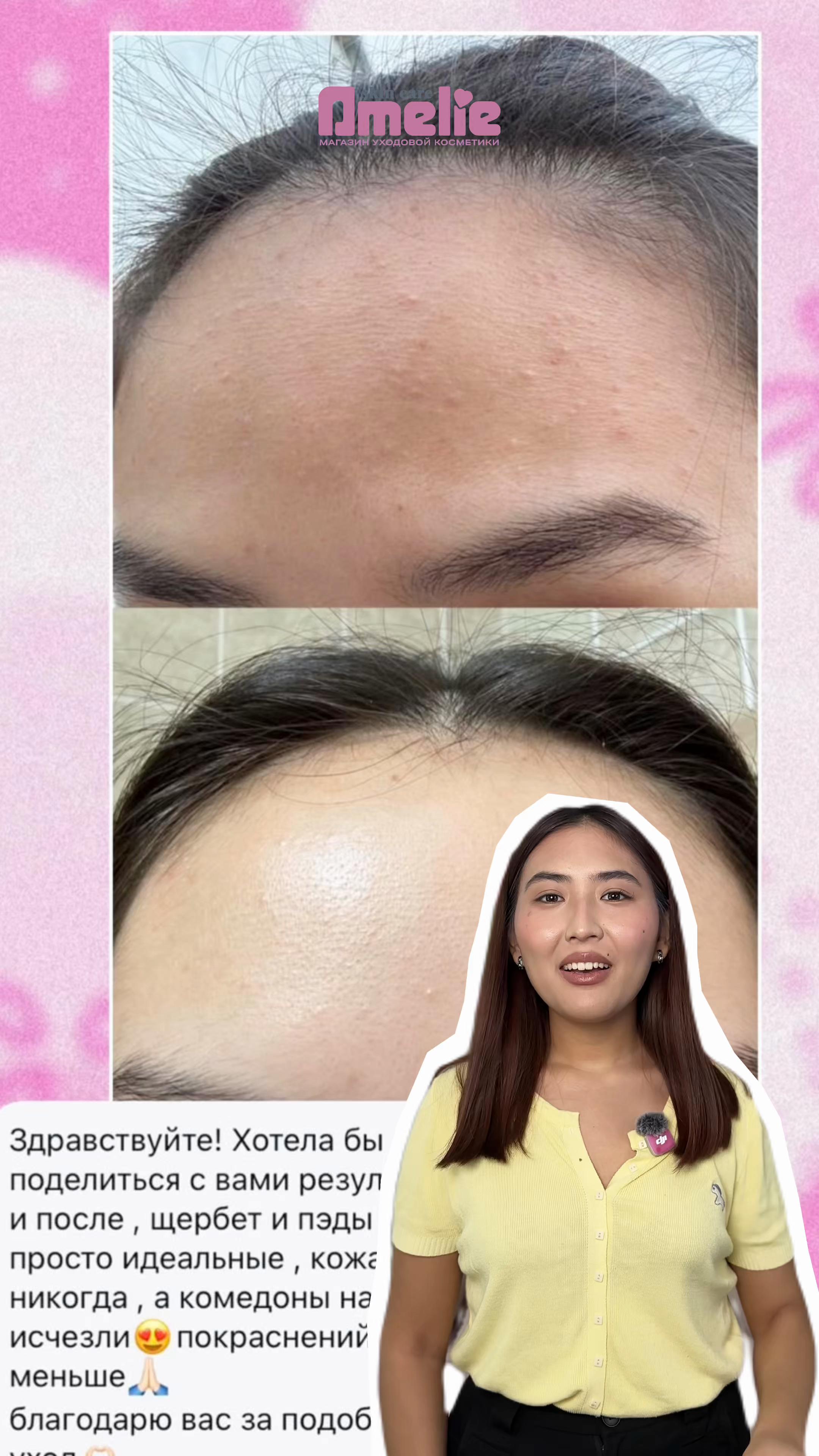 @amelieskin.kz