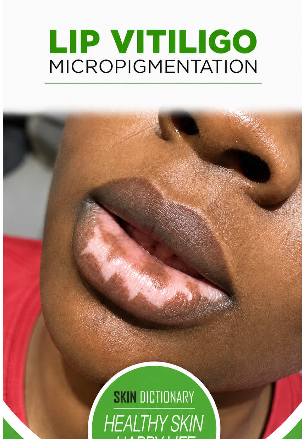 @Skin Dictionary