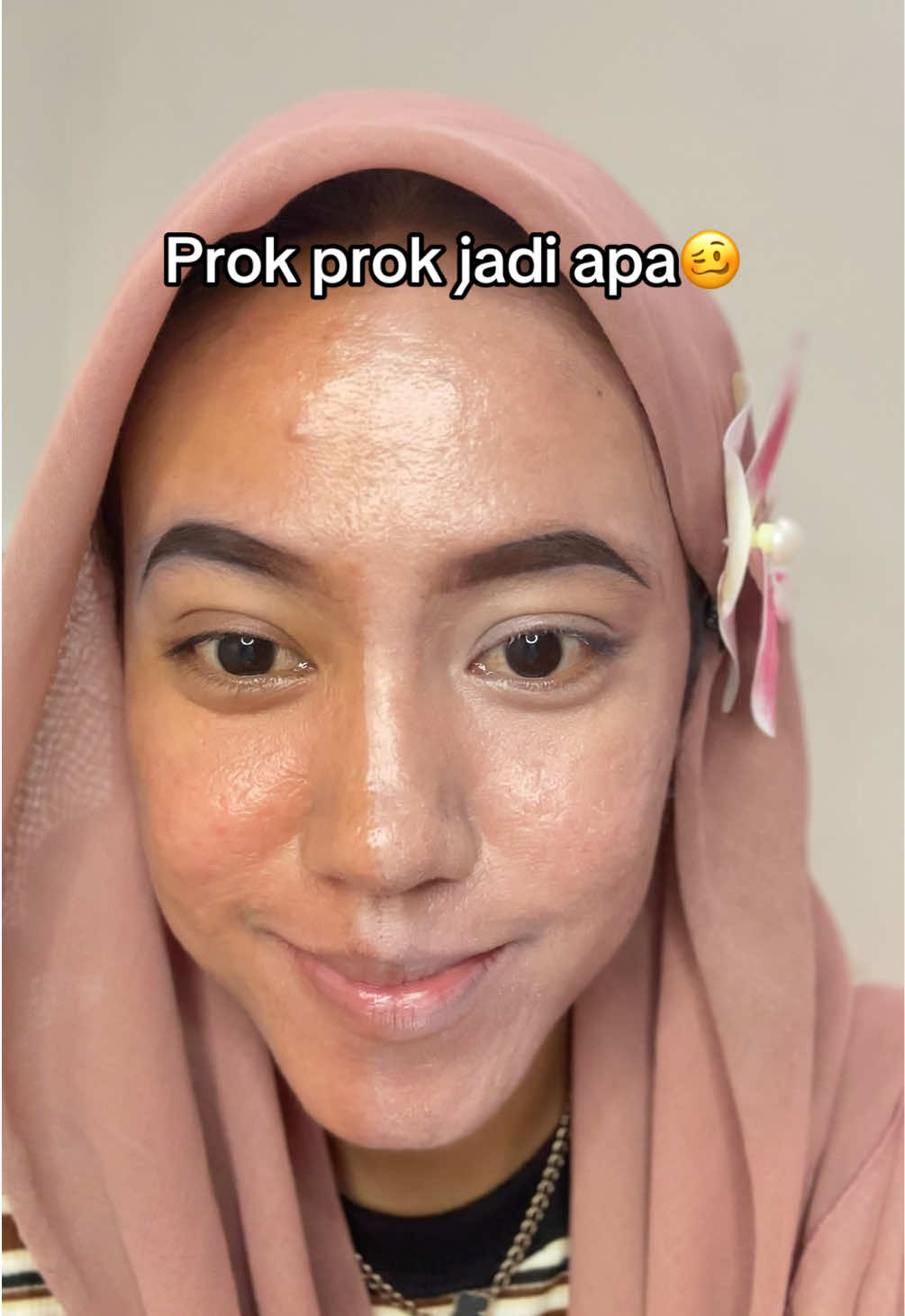 @Ichaa | acnefighter