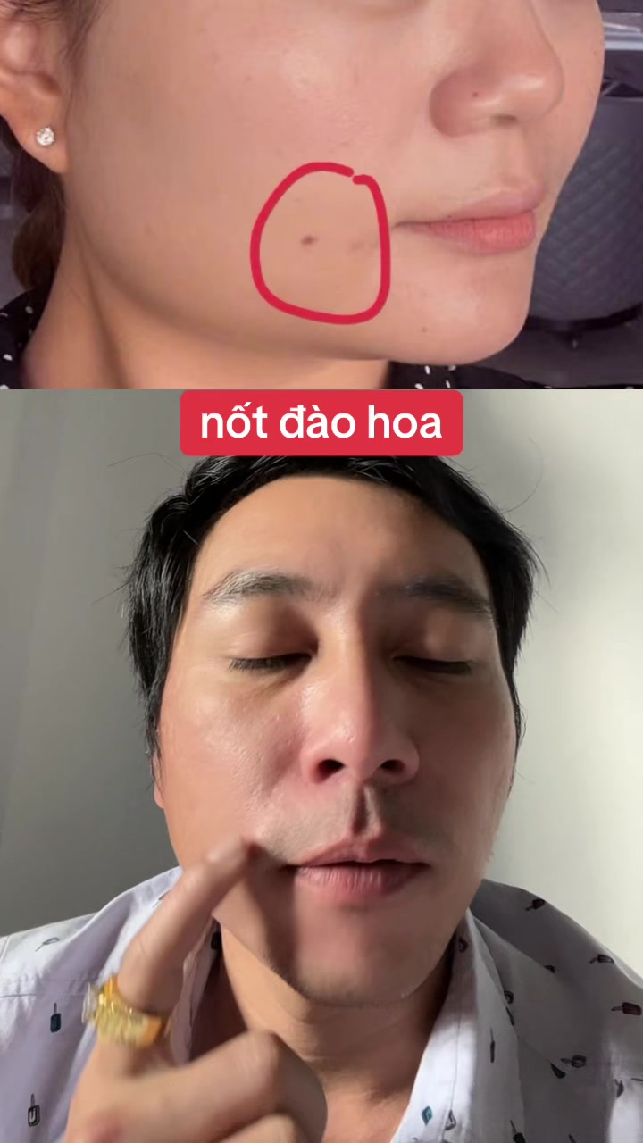 @Tuệ Nhãn ✅