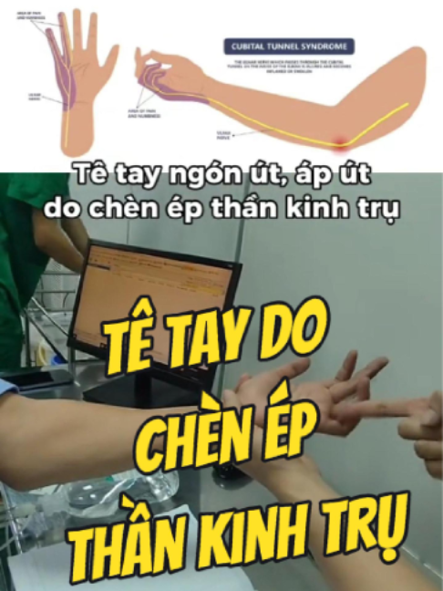 @Chuyên gia xương khớp