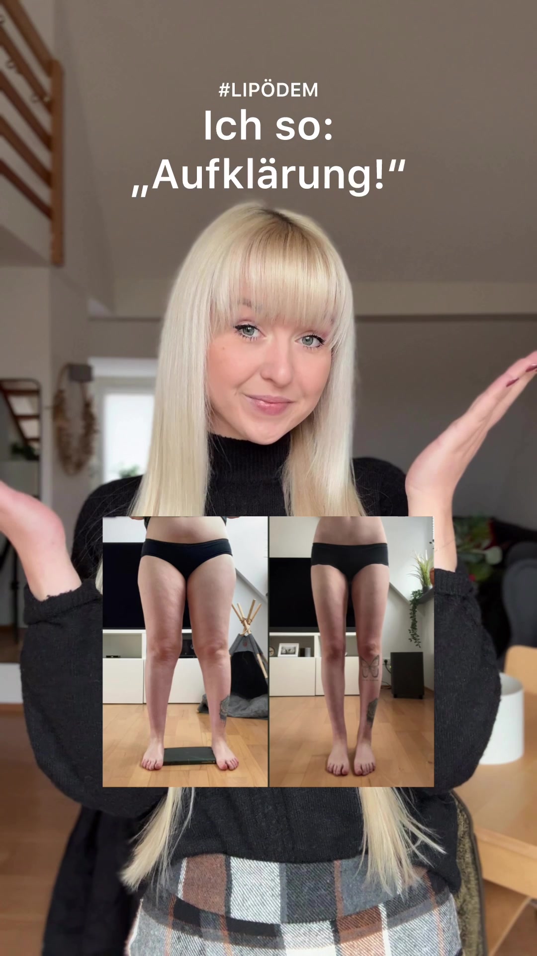 @maike | lipödem | ootd