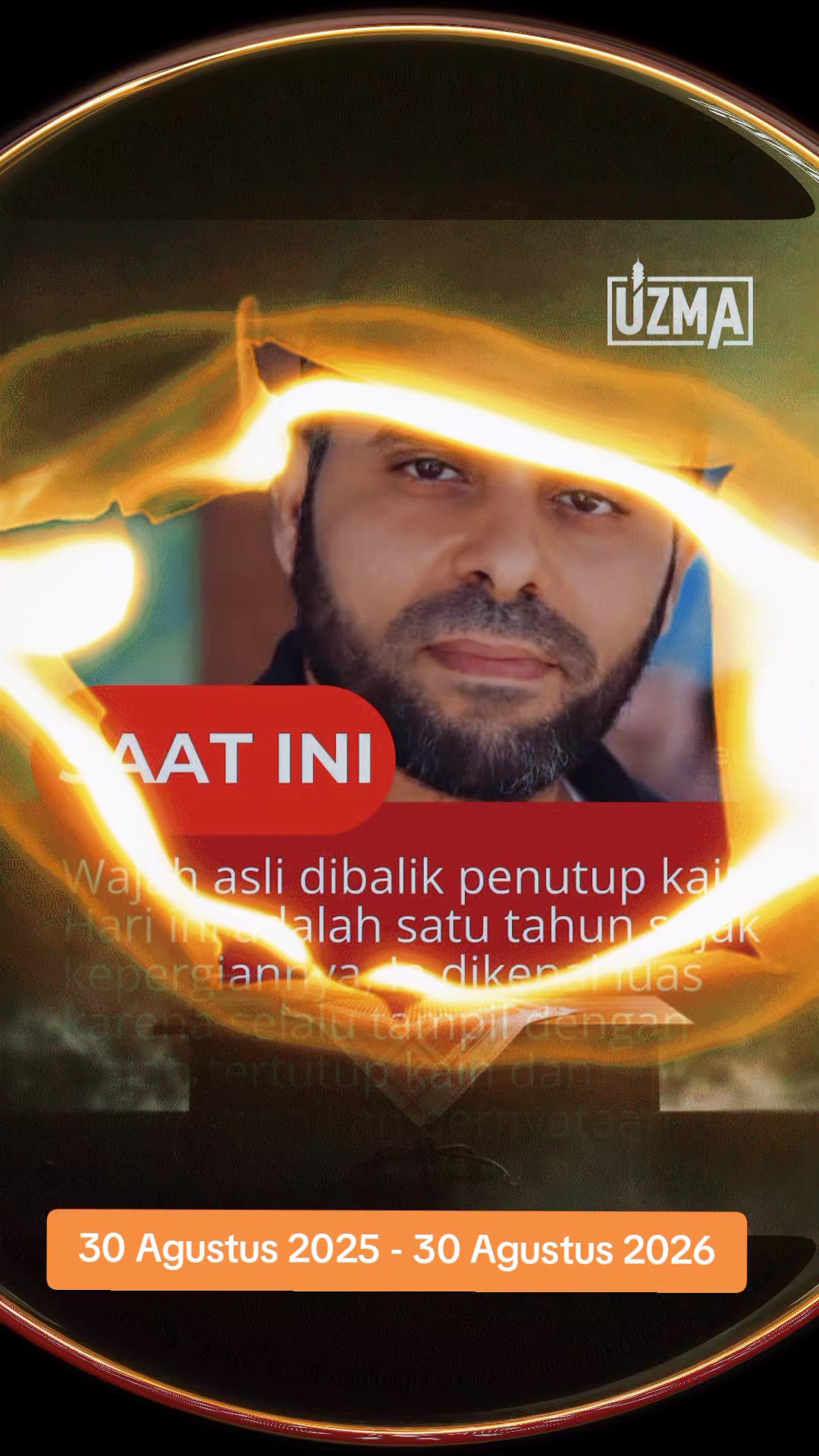 @NOS