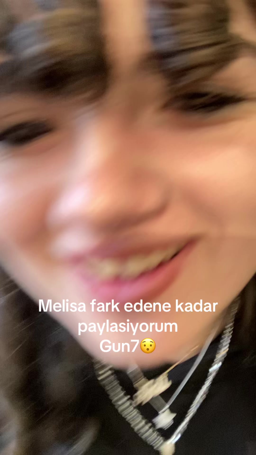 @melisafarkedenekadar✌🏿