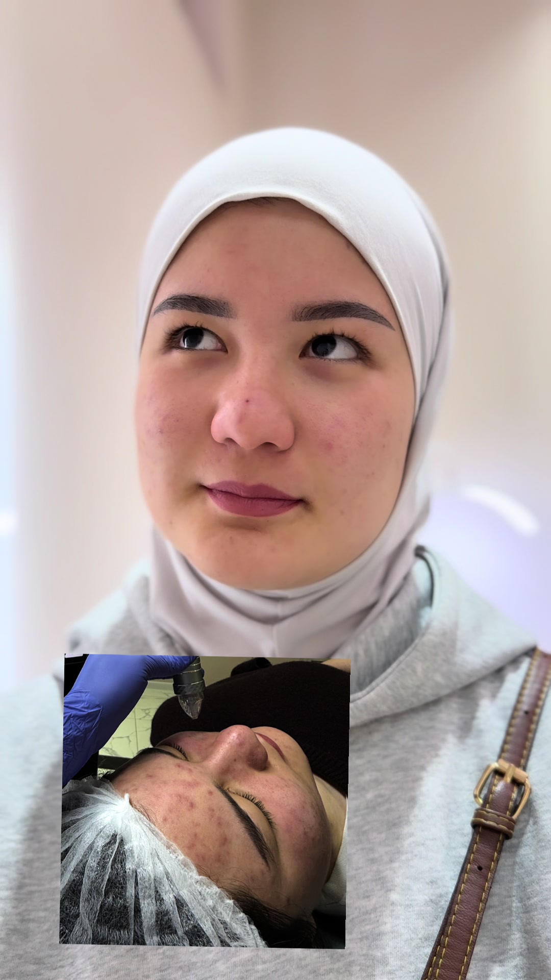 @kosmetolog_begim