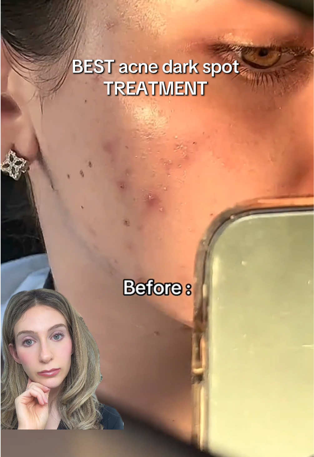 @Heather Kornmehl, MD
