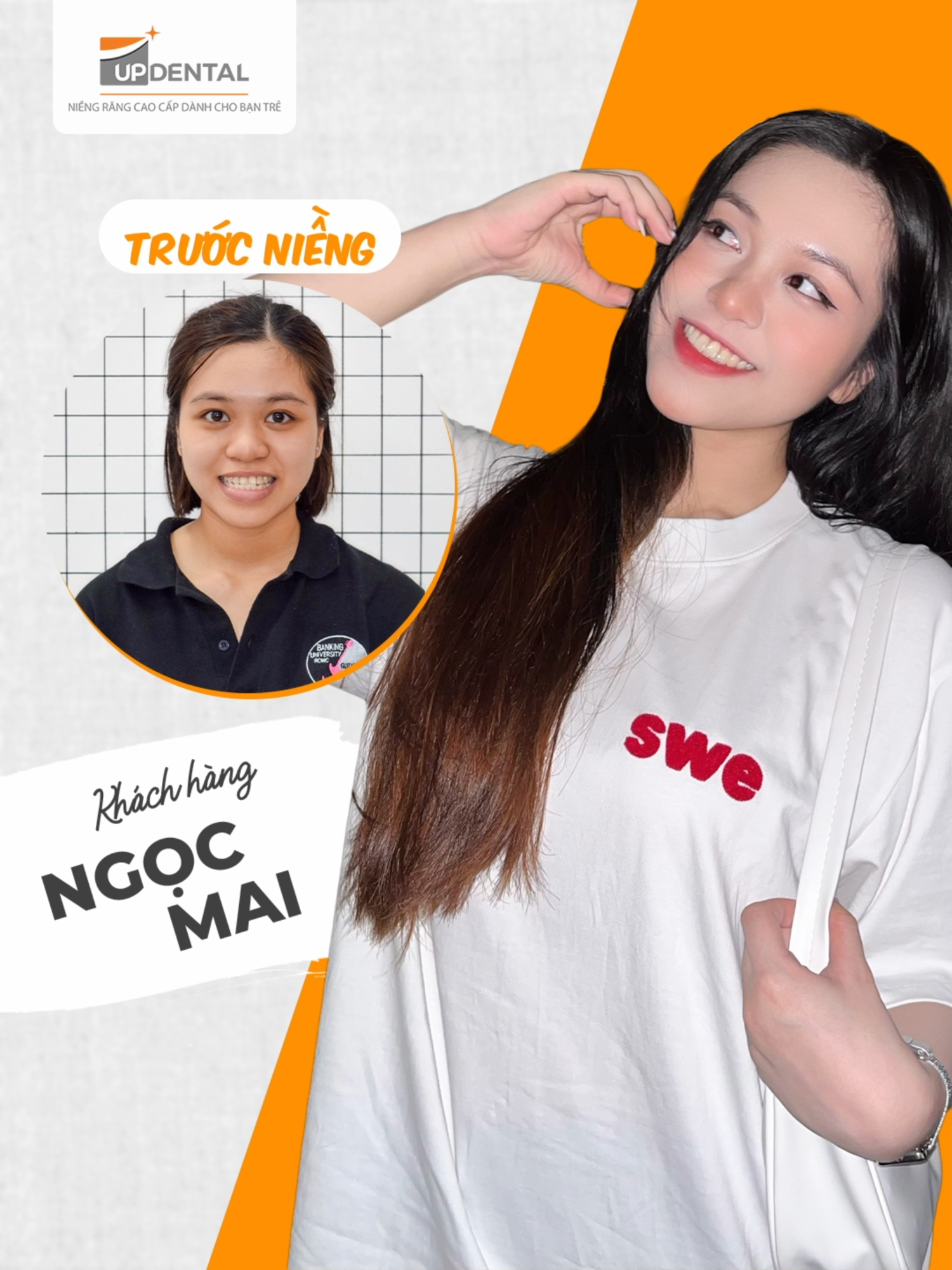 @Nha khoa niềng răng Up Dental
