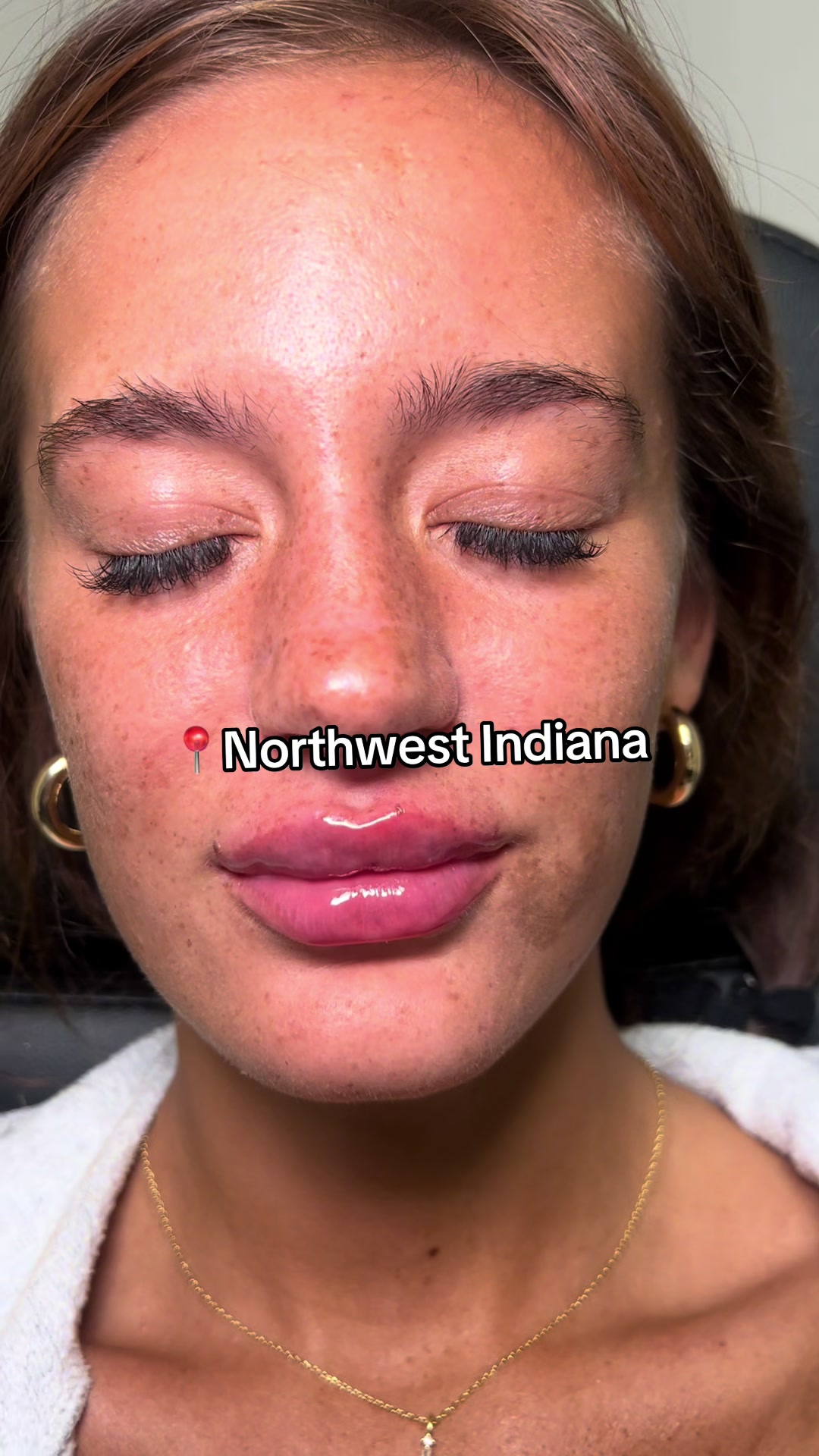 @Christy - NWI Aesthetic NP