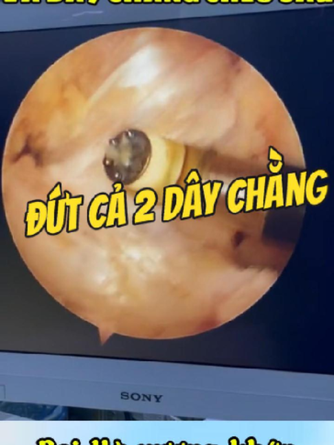 @Chuyên gia xương khớp