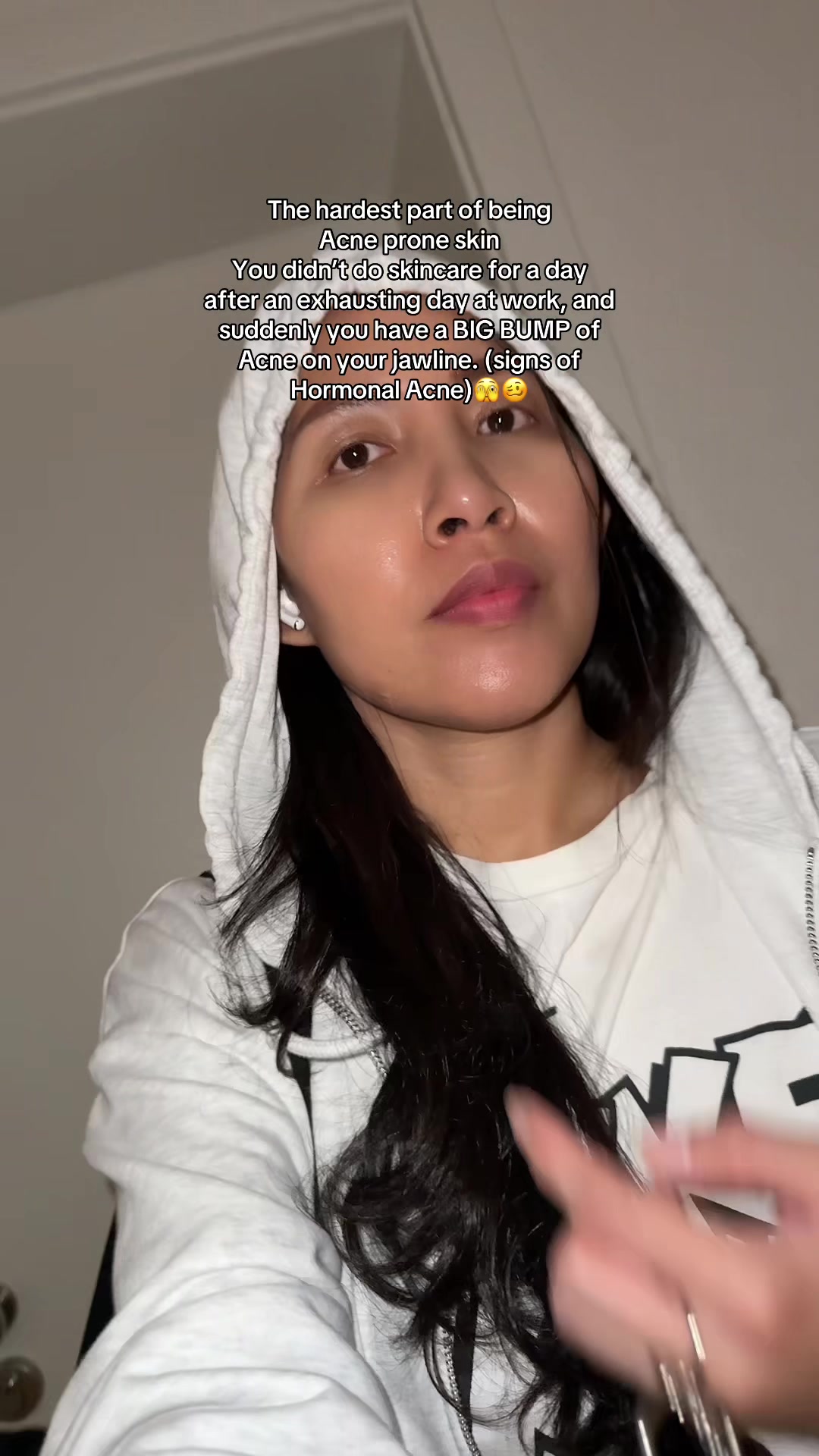 @storyofanacnefighter