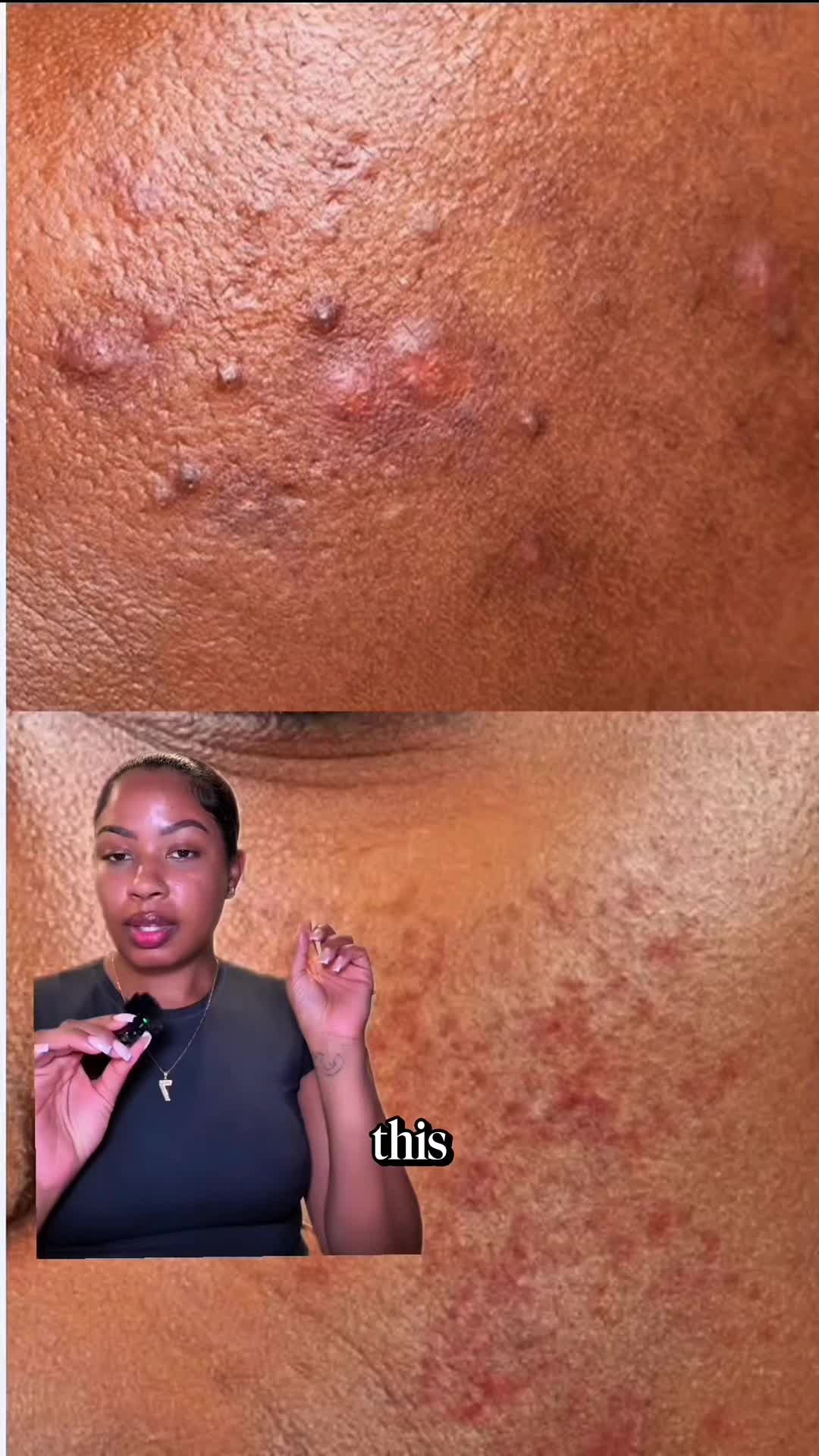 @Cristina 🫧 ATL Esthetician