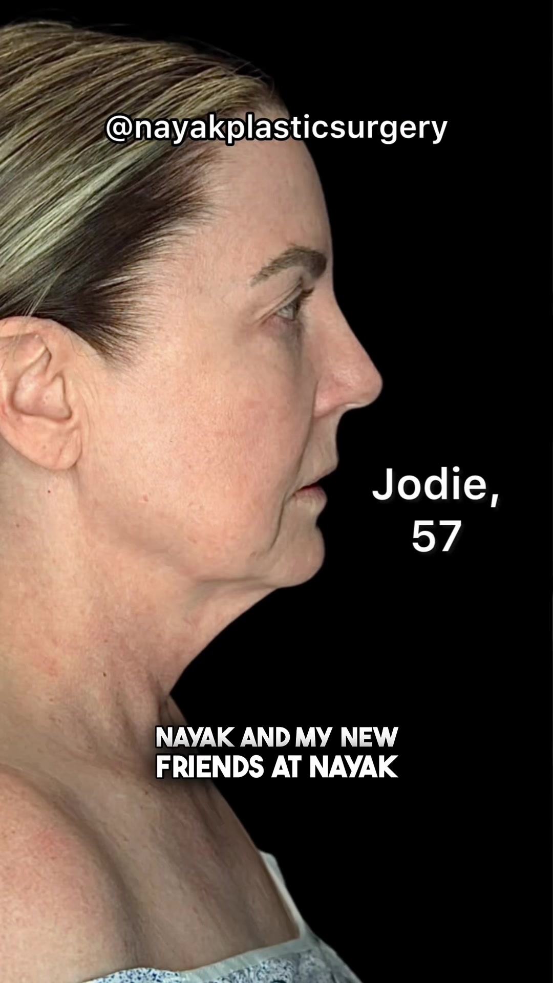 @NayakPlasticSurgery