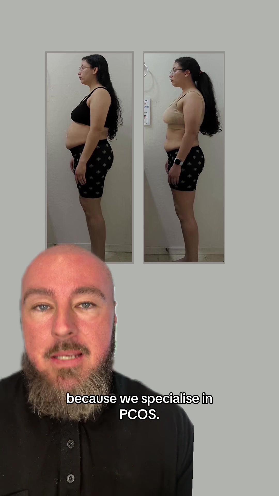 @Drew&ensp;Baird&ensp;|&ensp;the&ensp;PCOS&ensp;mentor