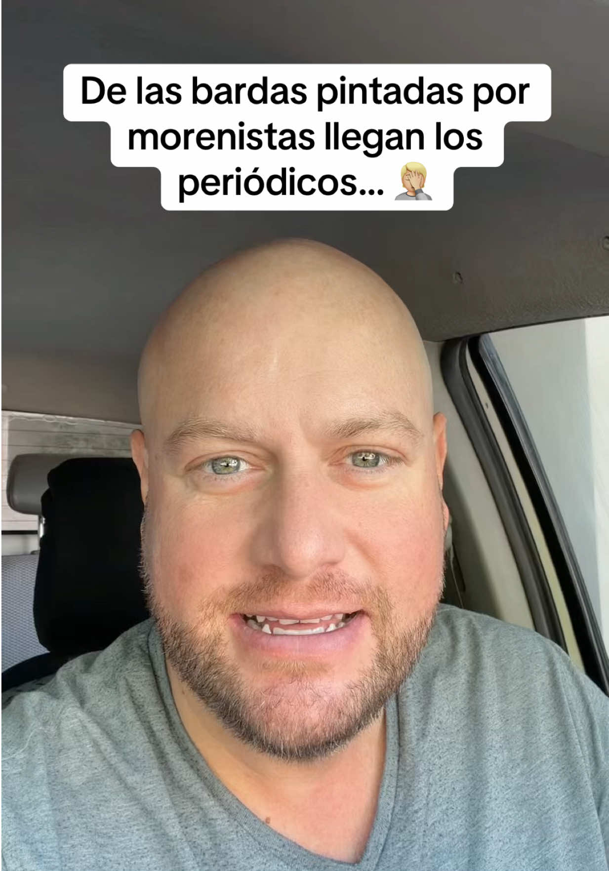 @Alberto Razo el pelon