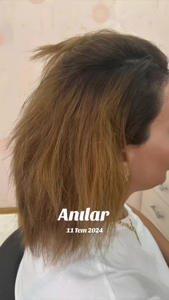 @şükranmetli saç kaynak merkezi