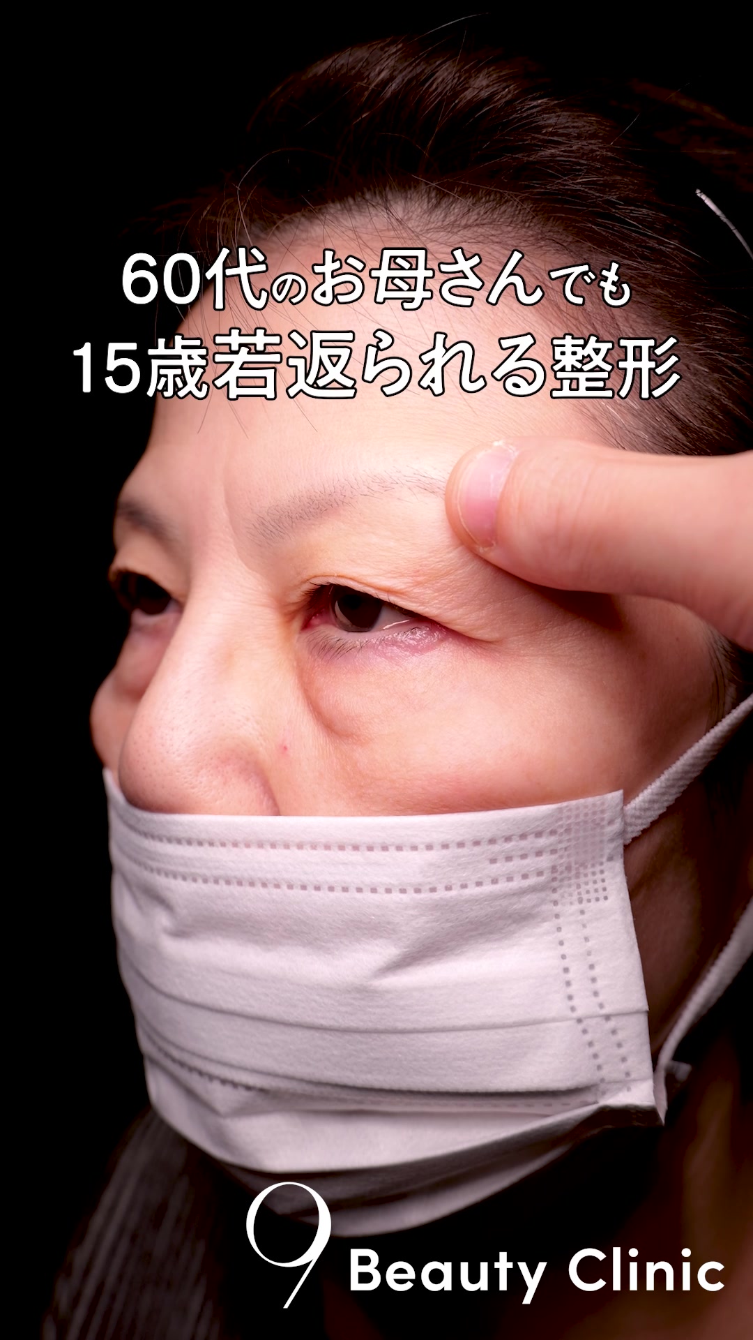 @りく先生　目元切開/クマ治療