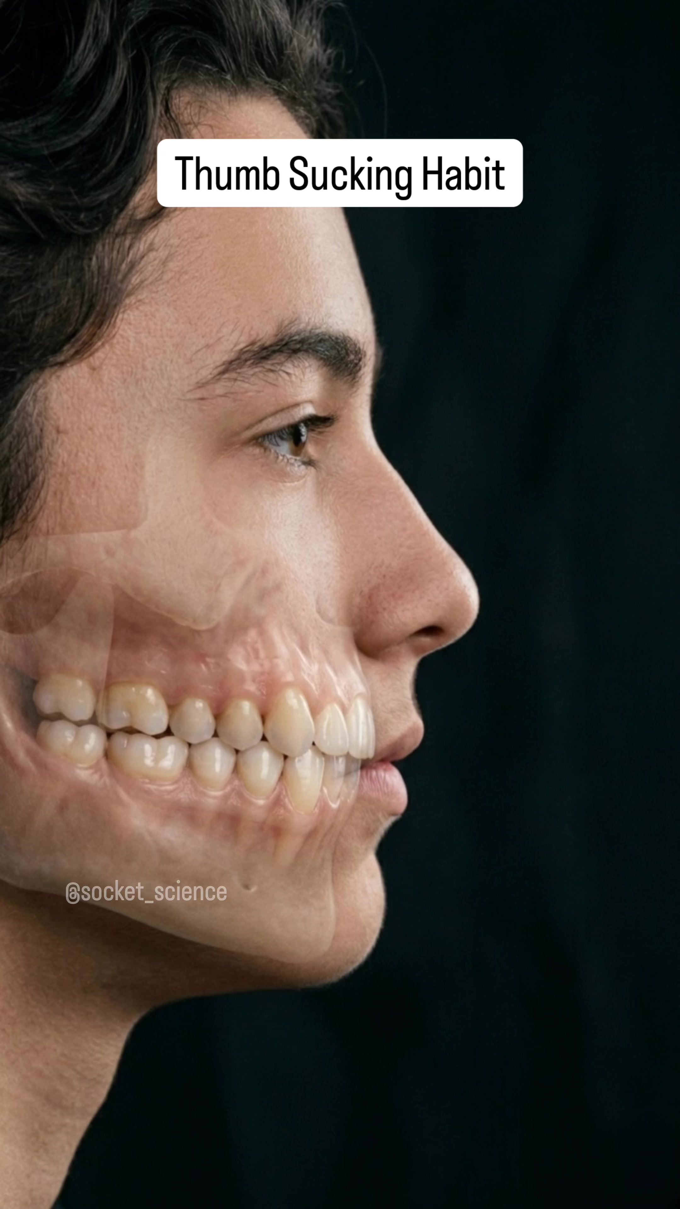 @Socket Science | Dental Visual