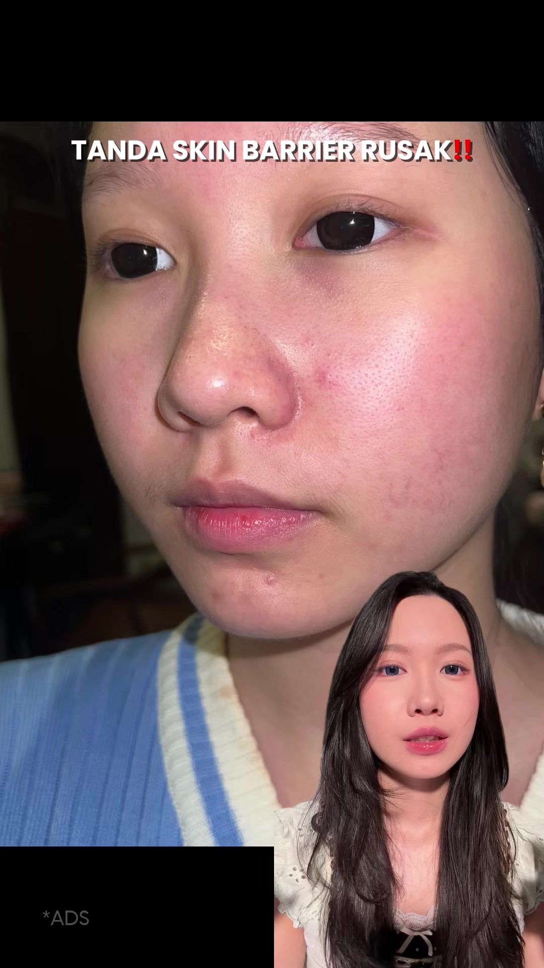 @Helen M. Nata