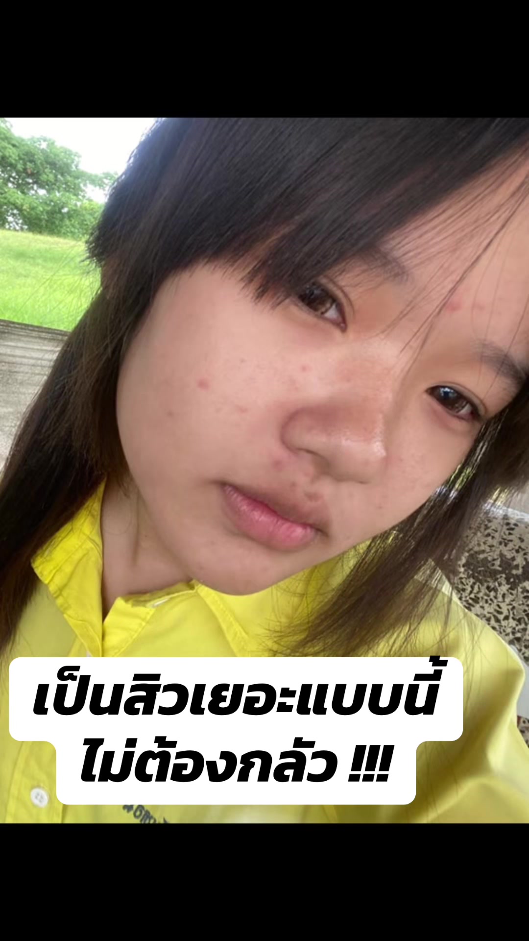 @LAMILA THAILAND