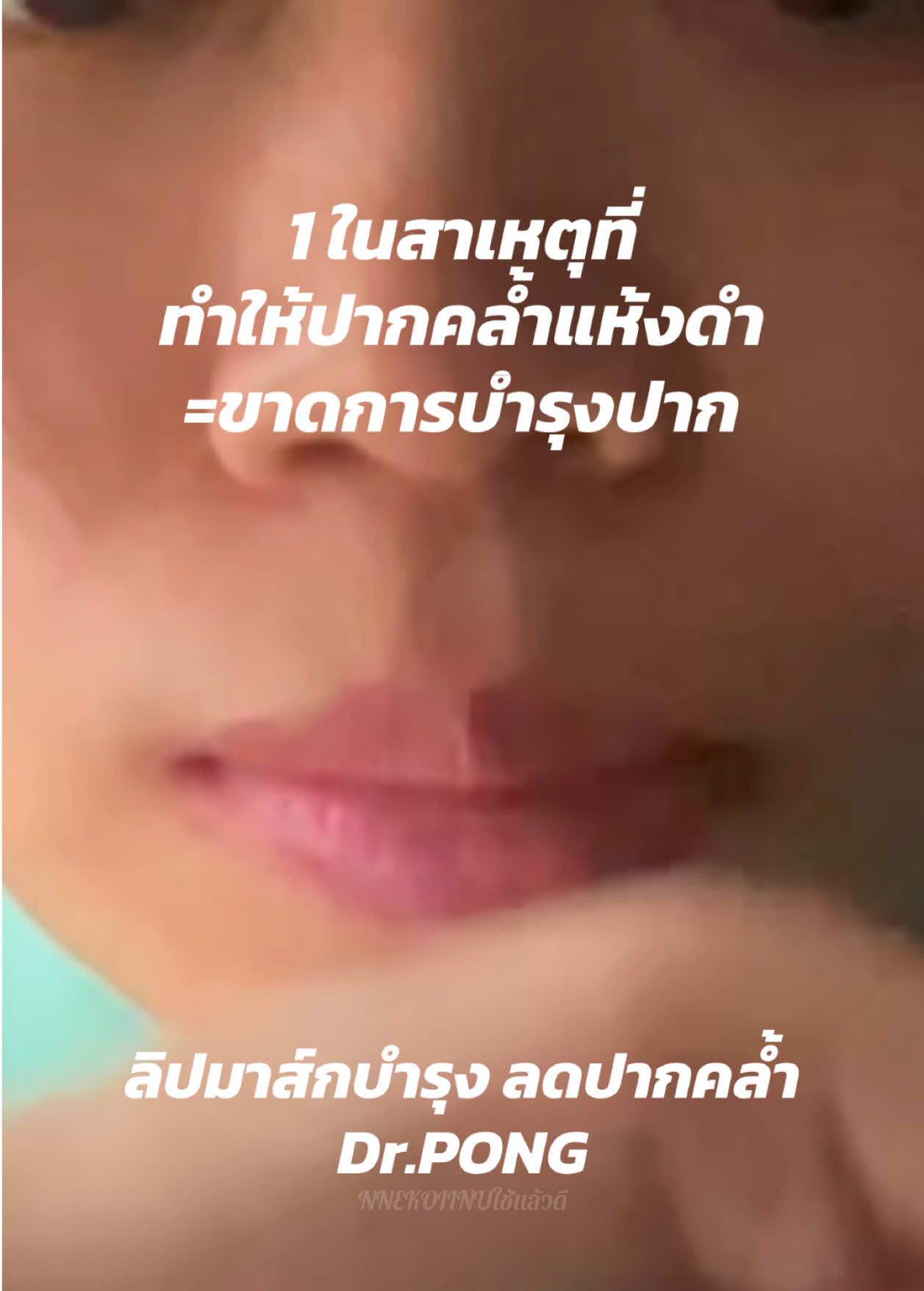 @NNEkOIINUใช้แล้วดี