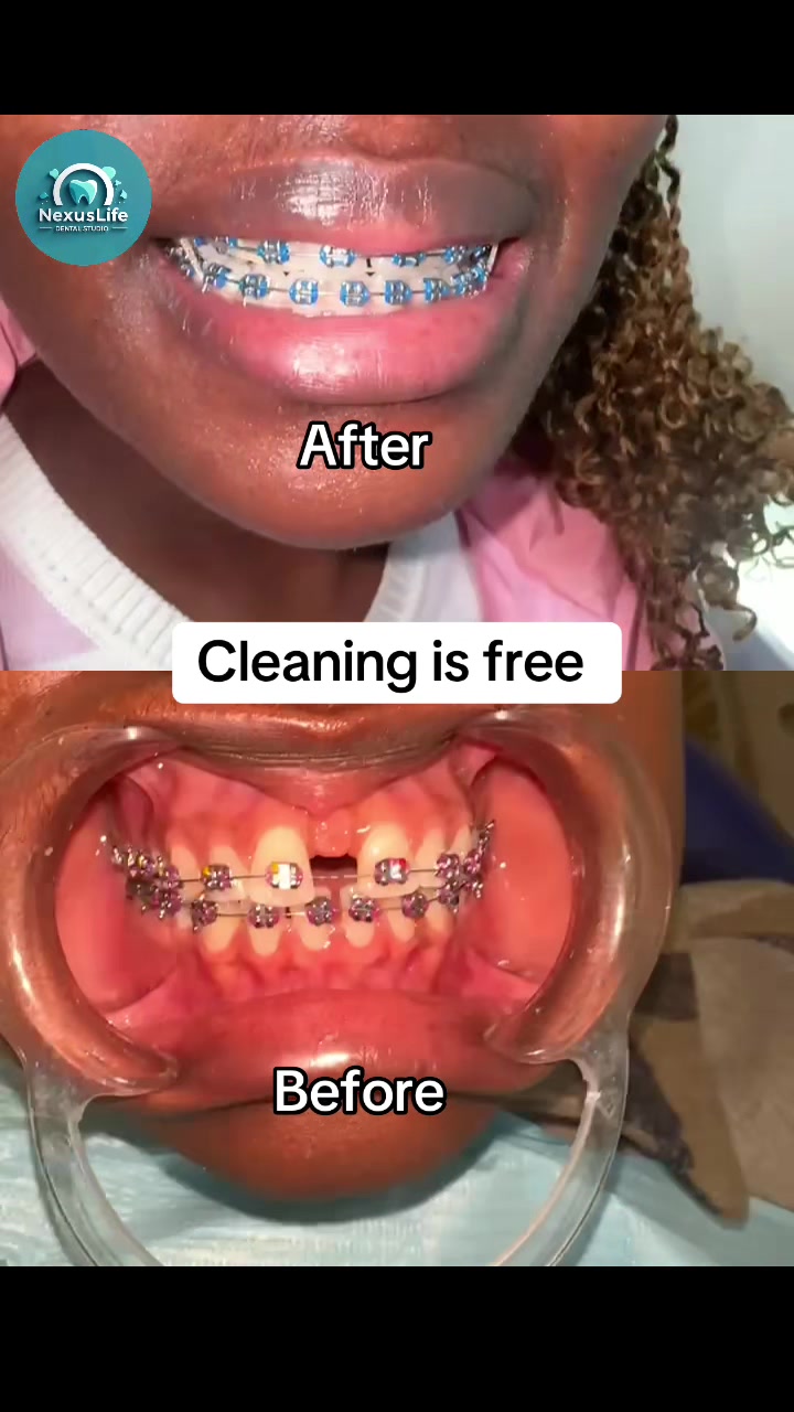 @NEXUSLIFE DENTAL CLINIC🦷