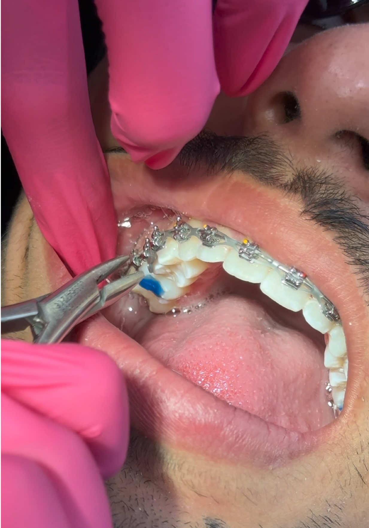 @Pure Orthodontics