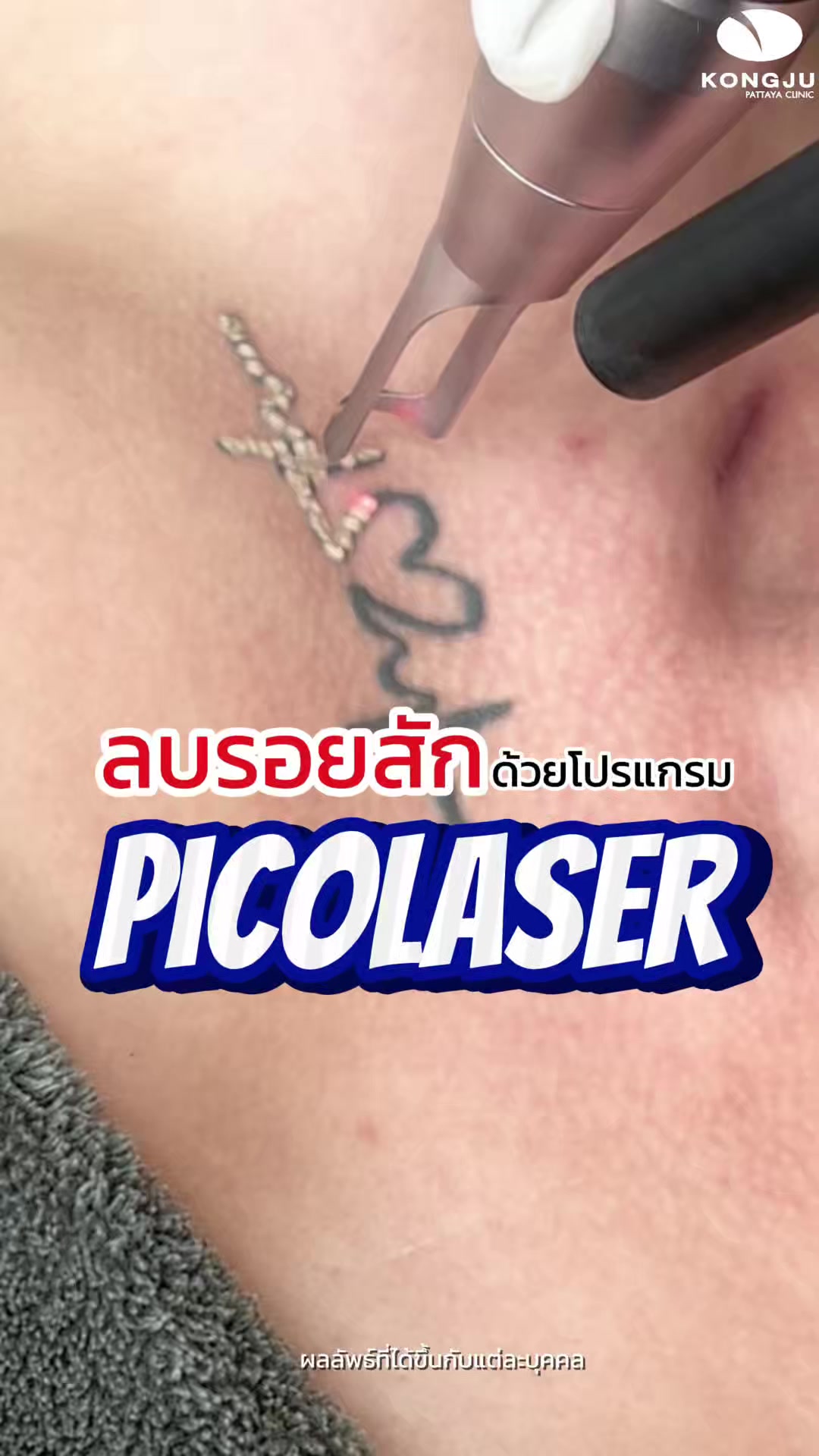 @กองจู พัทยา