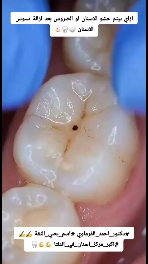 @دكتور احمد طلعت الفرماوي