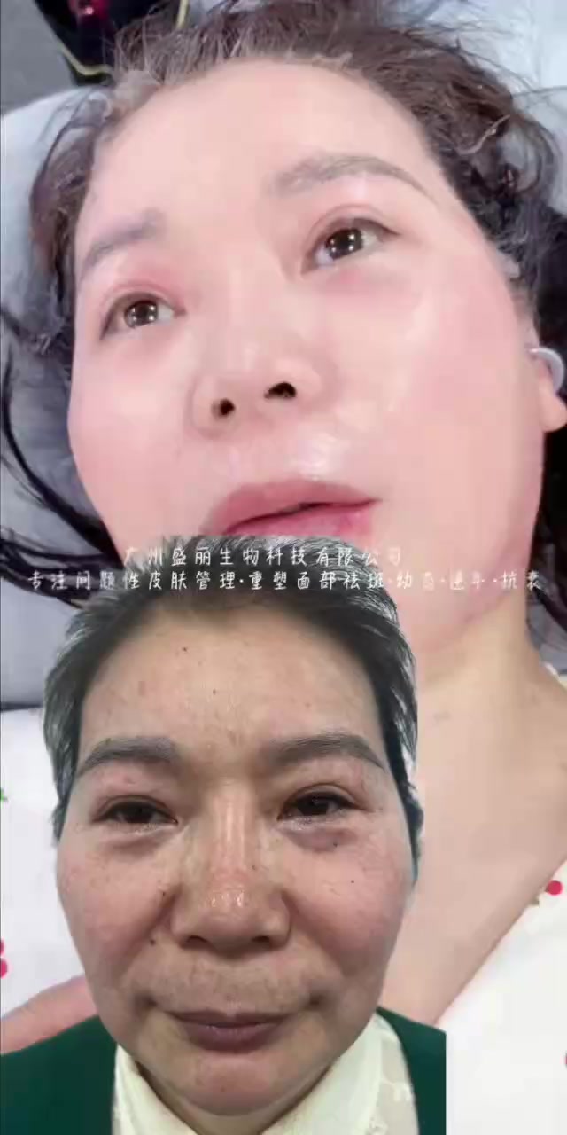 @培植膜创始人王盛艳