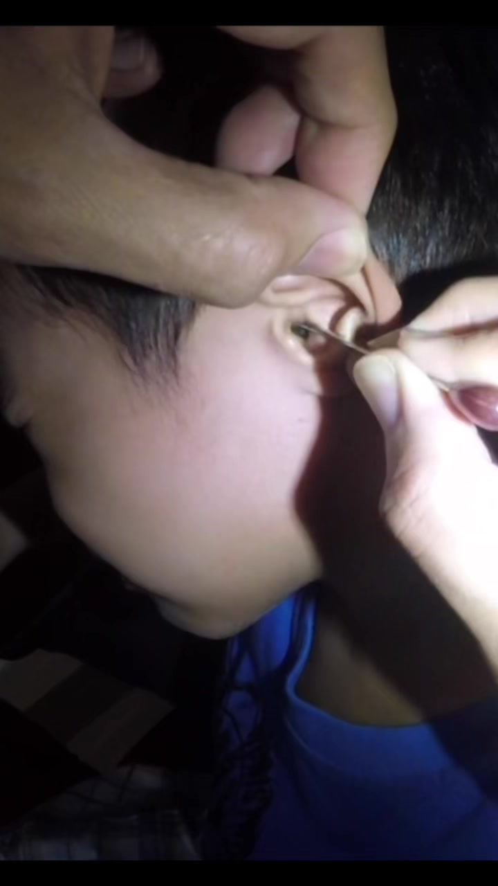 @TheEarwaxSpecialist