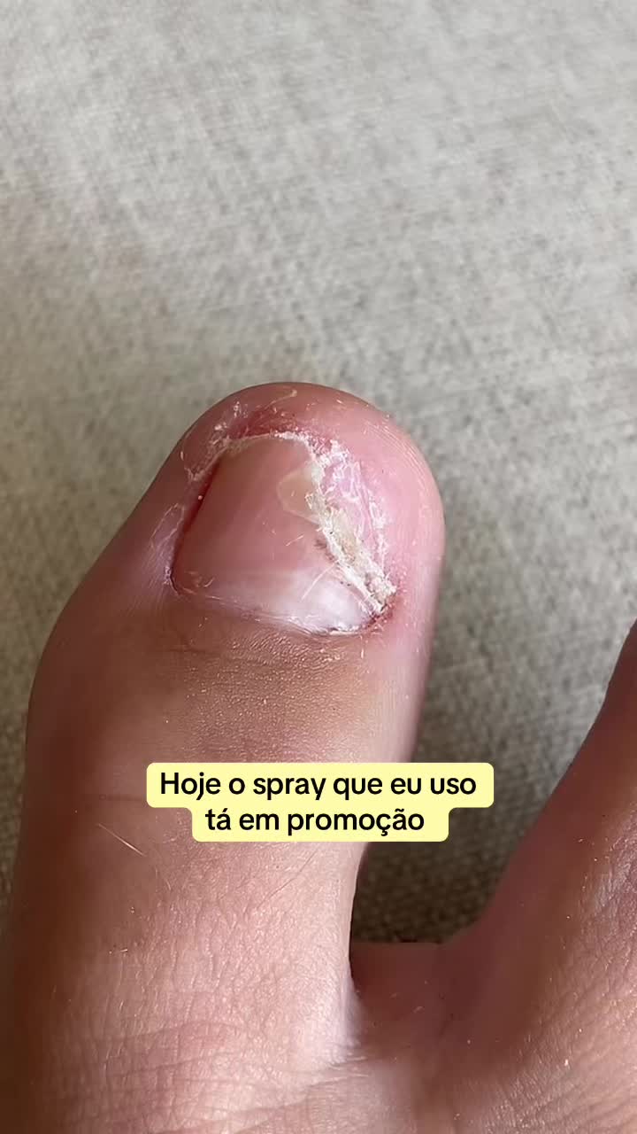 @Carolinaindica