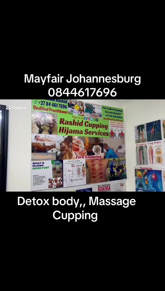 @Rashid 🇿🇦 🇵🇰Hijama Cupping