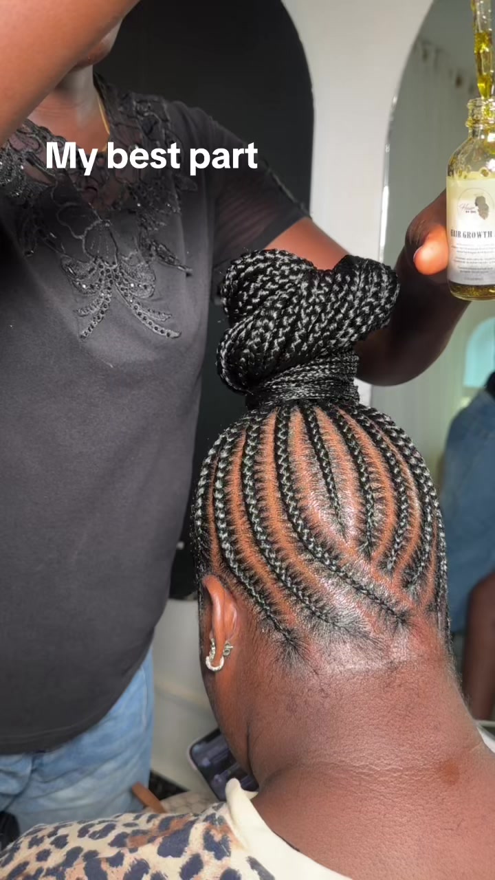 @Pemisire hairline