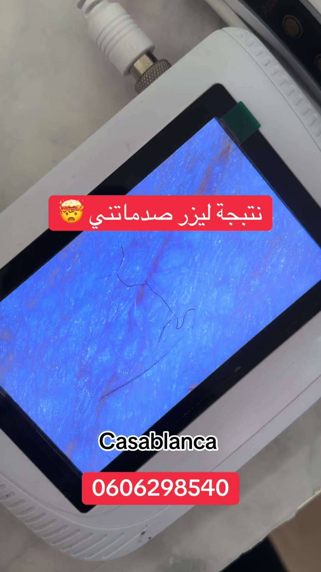 @esthesaraa