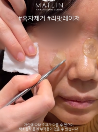 @메이린의원대구점