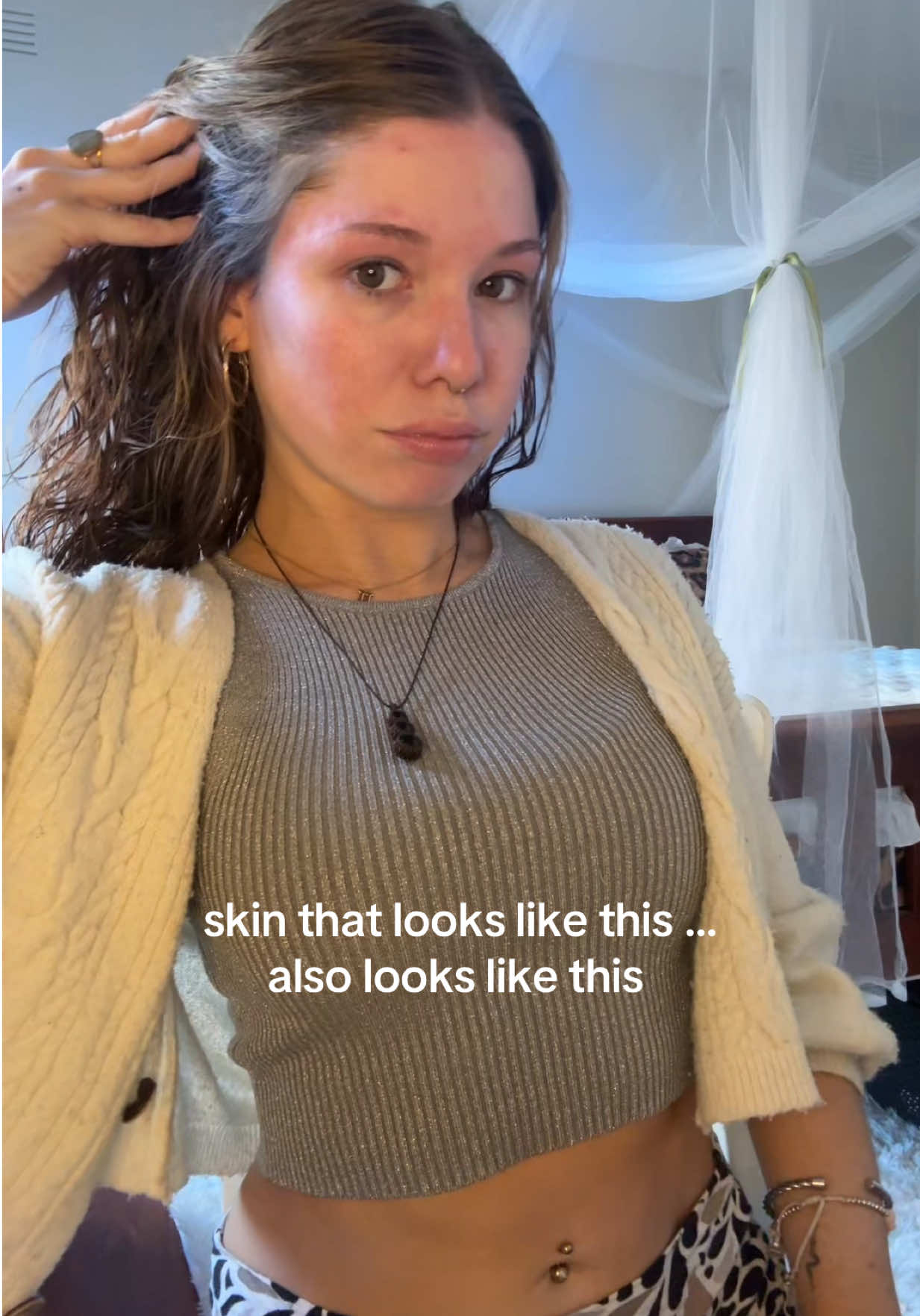 @Mimi