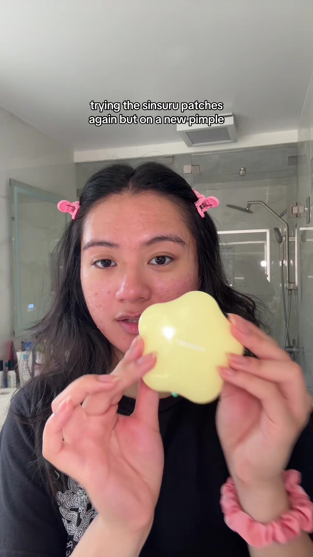 @jennilee • thatacnegirlie