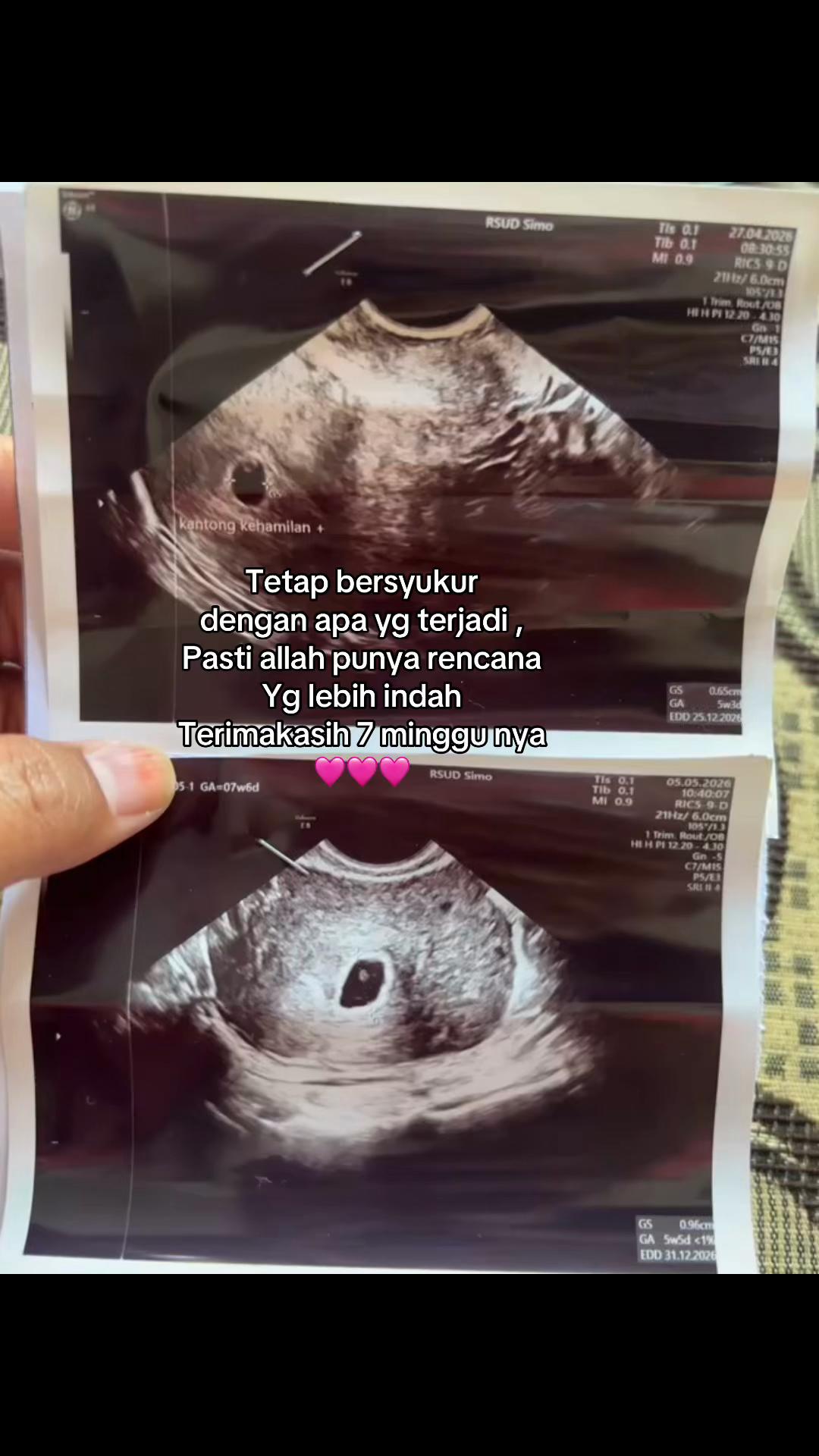 @Fitriyani