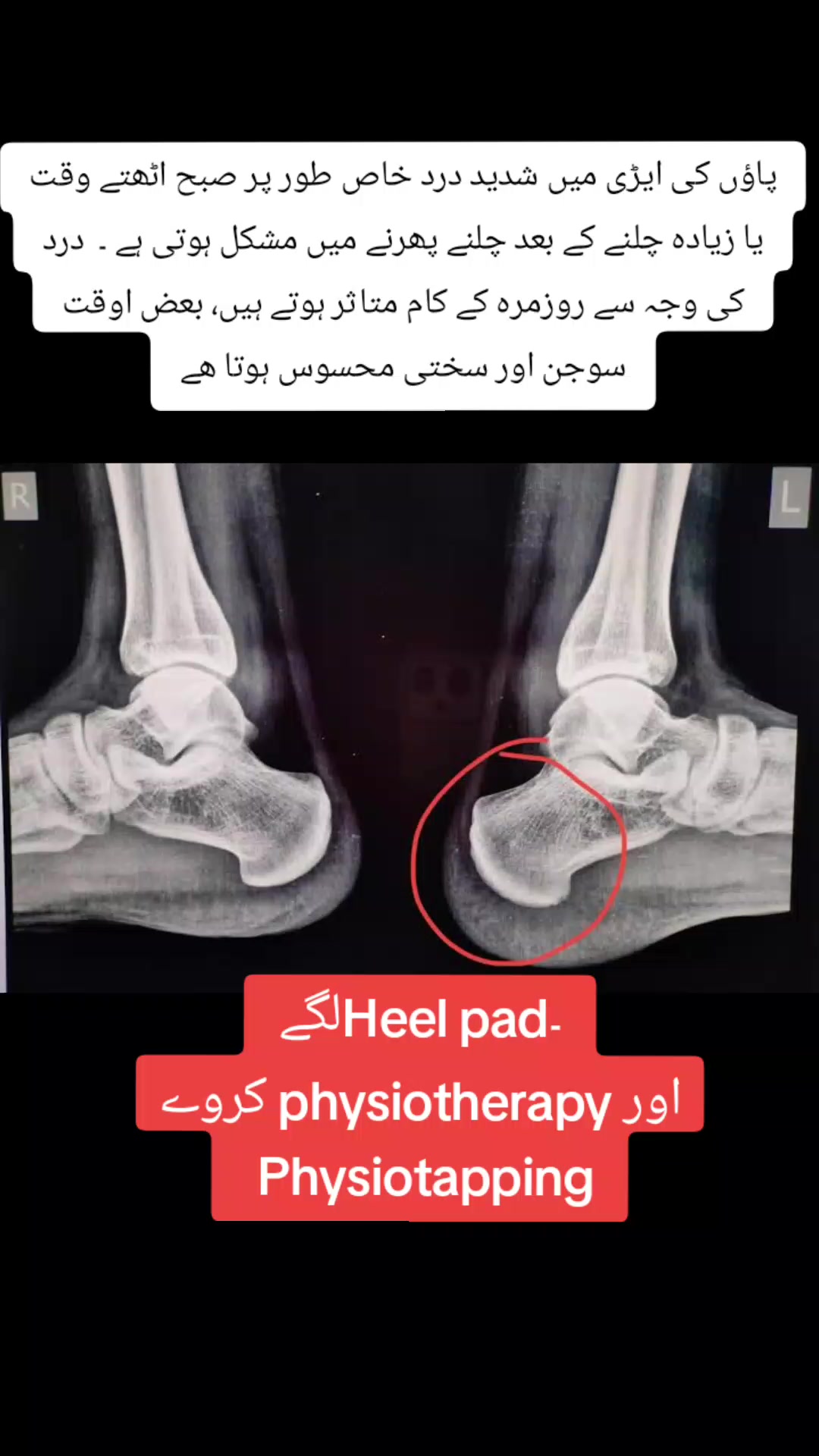 @Dr wadood