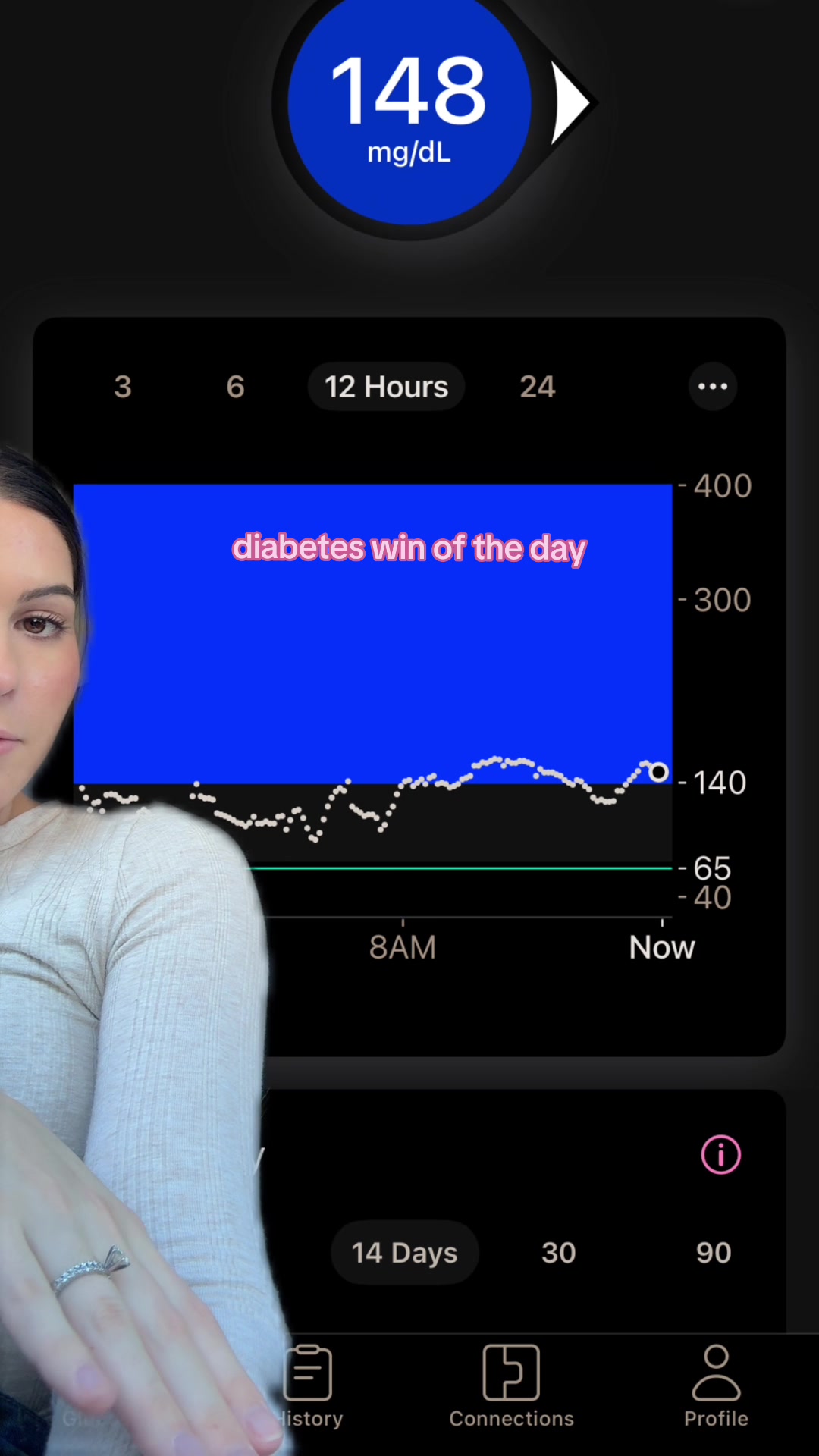 @Peyton l T1D