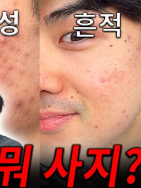 @털털이 TTE