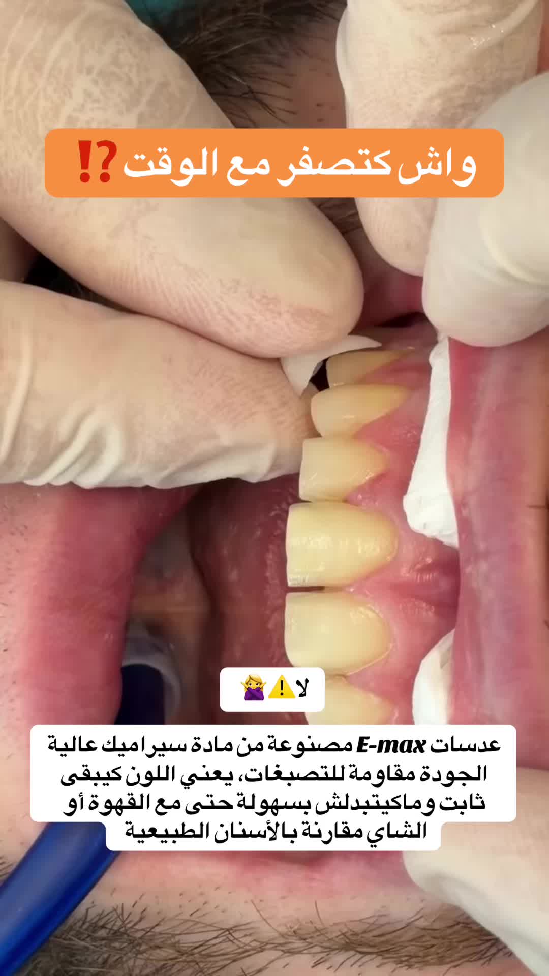@brightsmileee1
