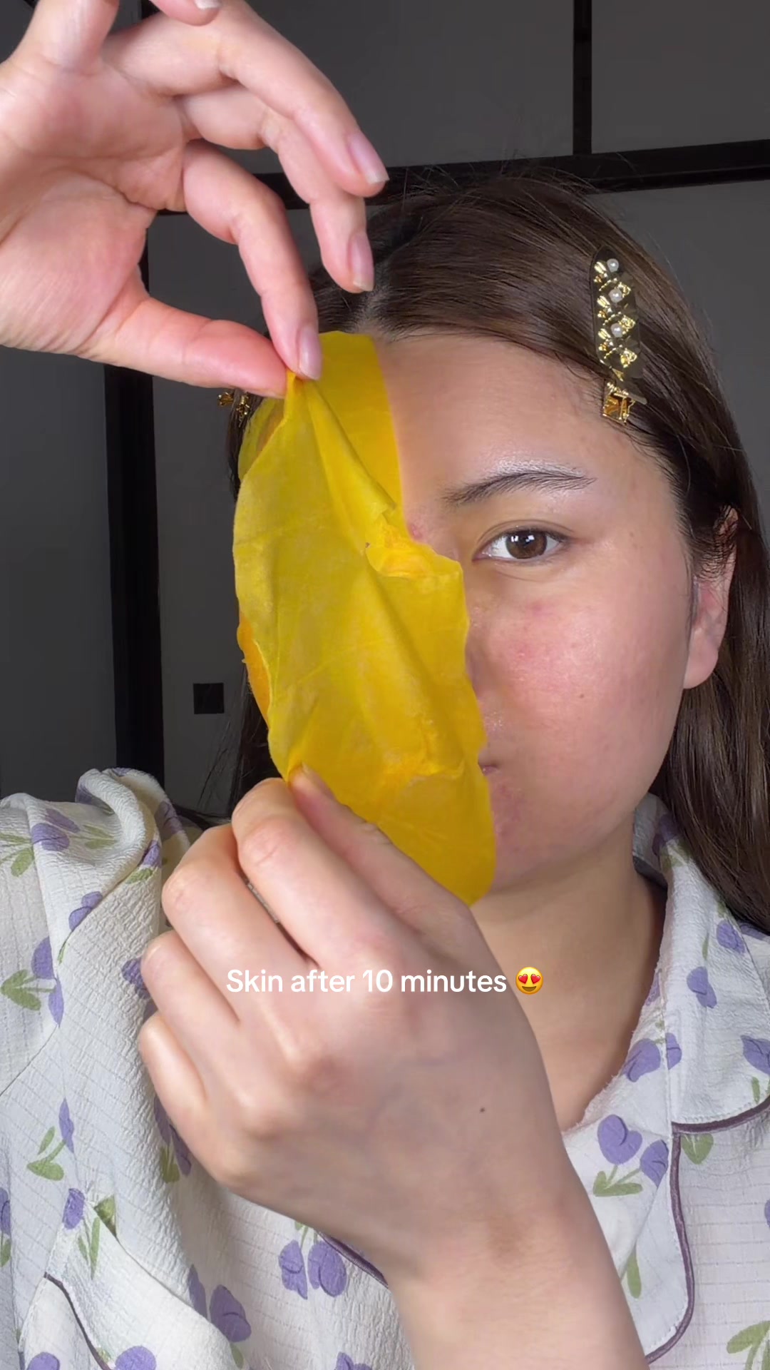 @Sonuka๐ขึดเป๐เผโ