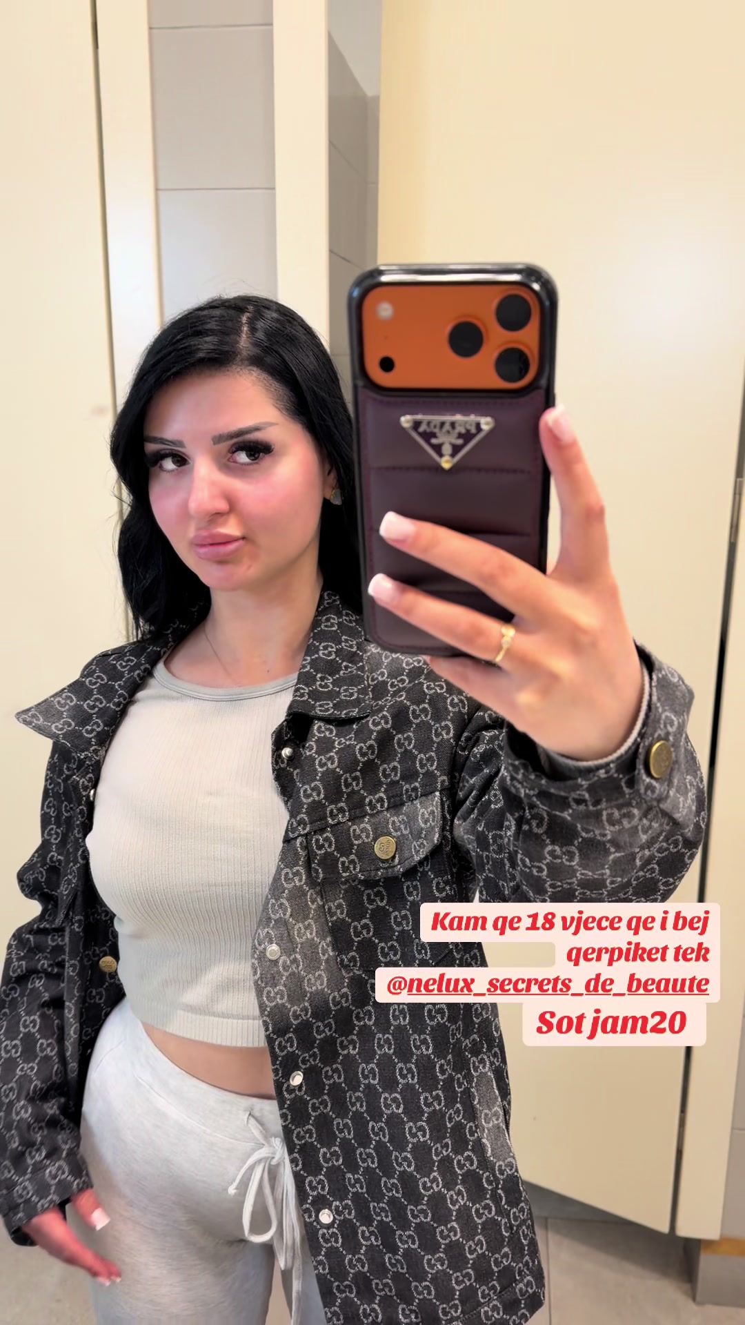@Bllokojamosjahaprrugen4🎭