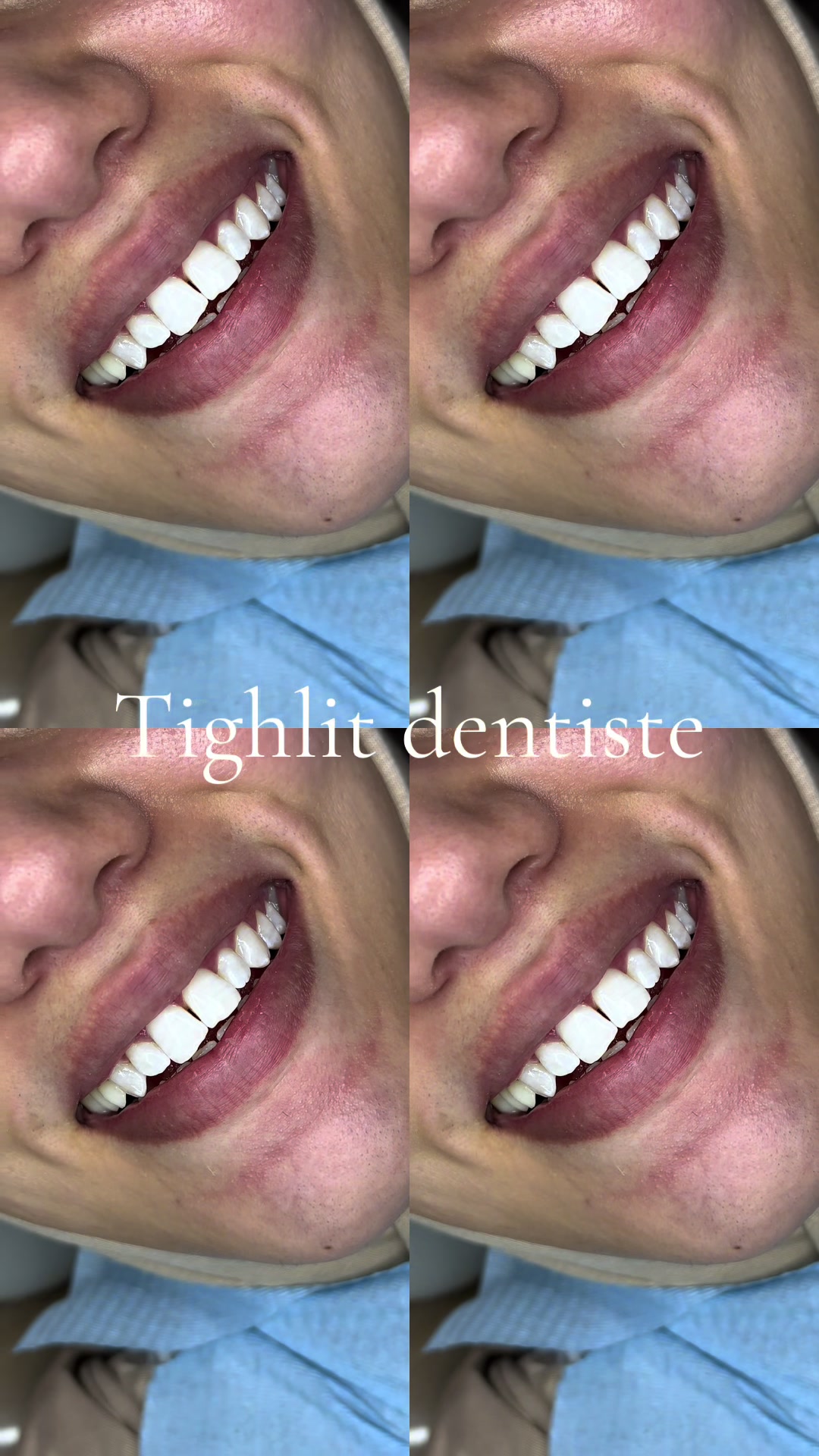 @tighlit_dentiste🦷